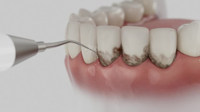 Trusted Dental Implants service in Russiaville, IN - Dentist Open Now